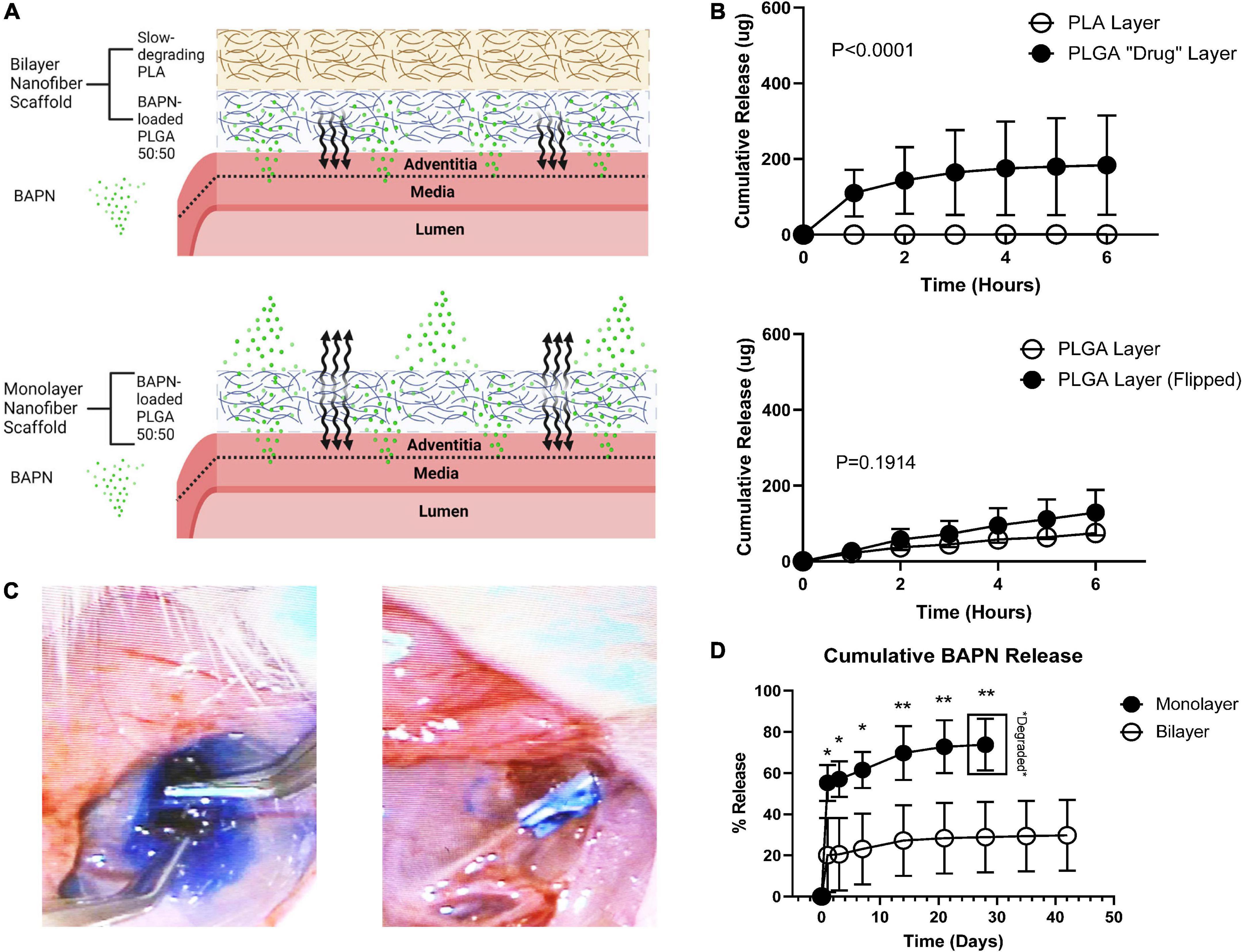 Periadventitial β-aminopropionitrile-loaded nanofibers reduce fibrosis and improve arteriovenous fistula remodeling in rats